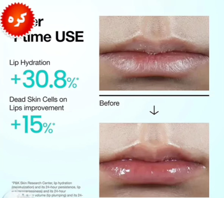 سرم لب PDRN آنوا آبرسان و ترمیم کننده | Anua PDRN Lip Serum